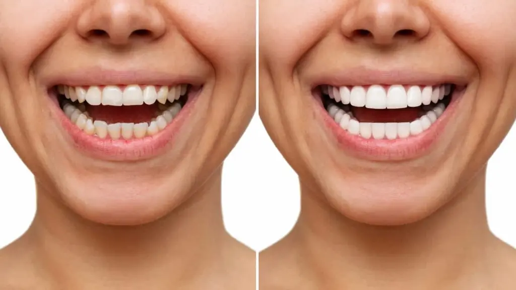 before and after shots ezgif.com jpg to webp converter